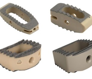 Cornerstone Titanium Coated