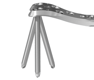 VA-LCP CONDYLAR PLATE