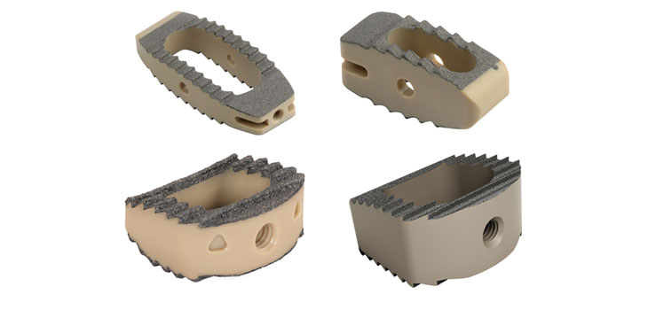 Cornerstone Titanium Coated